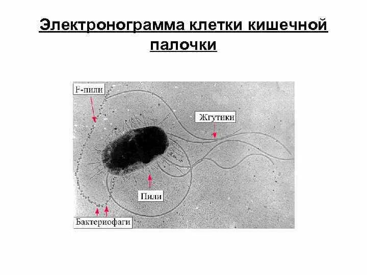 Электронограмма кишечной палочки. Электронограмма бактерии. Кишечная палочка строение клетки. Кишечная палочка жгутики.