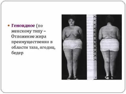 Отложение жира