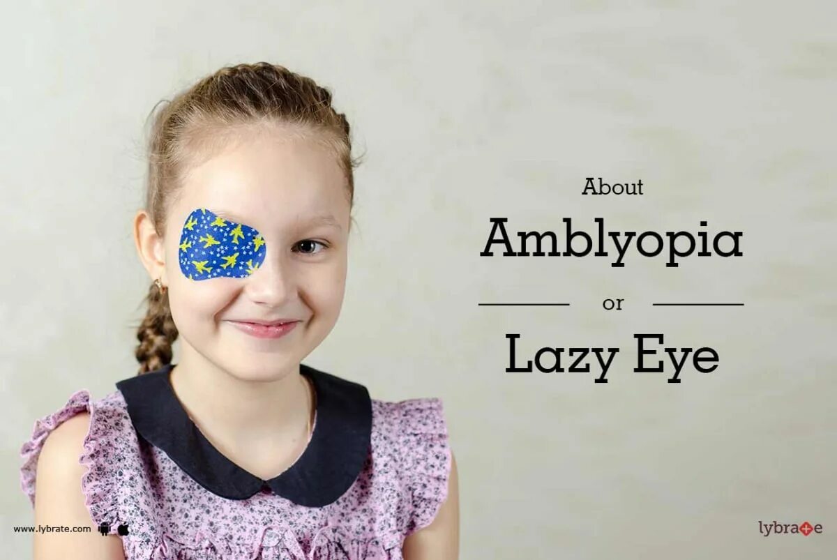 Lazy eye. Lazy eye - soulship. severe amblyopia (lazy eye. lazy eye book.