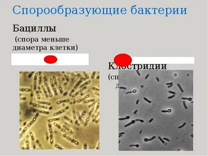 Споры образуют виды бактерий