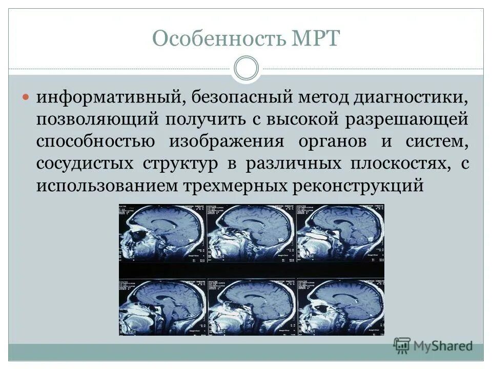 Метод магнитно-резонансной томографии. Информативность мрт. Кт и мрт сходства и различия методов. Информативность мрт. Обследование на томографе.