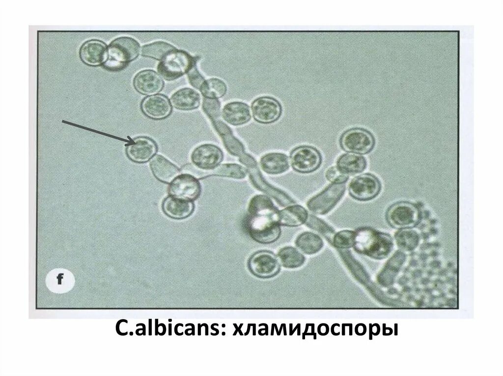 Споры candida. Кандида альбиканс микроскопия. Грибы кандида микроскопия. Хламидоспоры c.albicans. Хламидоспоры кандида.