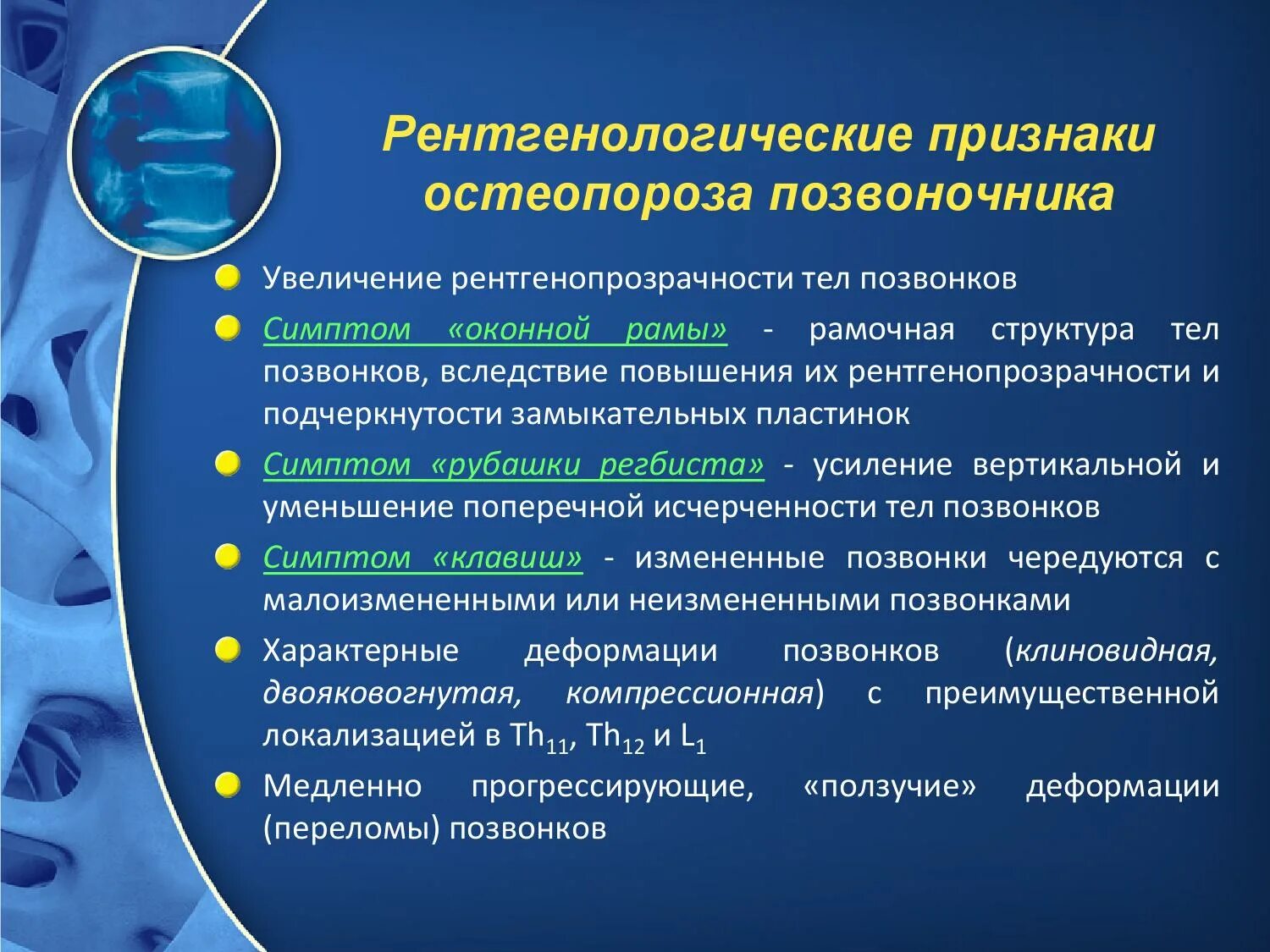 R признаки остеопороза. остеопороз костей симптомы. диффузный остеопороз костей стопы. клинические проявления остеопороза. остеопороз.