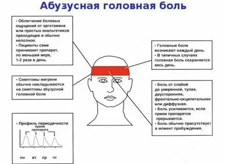 Если сильно болит голова в висках