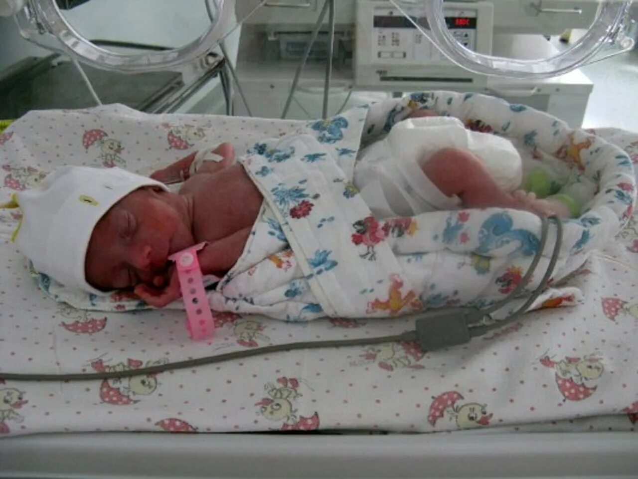 Семимесячный жеребенок. Маловесные Новорожденные. Недоношенный новорожденный ребенок. Первая неделя после рождения