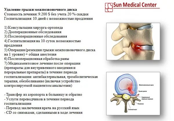 Грыжи позвоночника в поясничном отделе схема. Межпозвоночная грыжа поясничного отдела схема. Грыжа диска схема. Операция при грыже поясничного отдела схема. Удаления грыжи позвоночника поясничного отдела отзывы