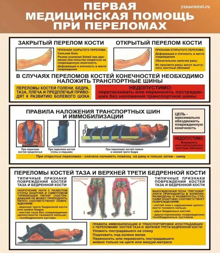 В случае открытого перелома. Переломы костей конечностей действия по оказанию первой помощи. Порядок оказания первой помощи при переломах конечностей. Порядок оказания первой помощи при переломе нижних конечностей. Перелом ПМП при переломах.