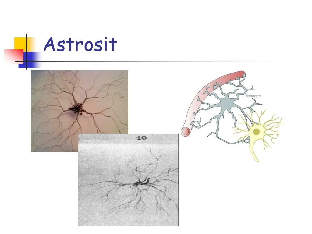 Глиальные клетки астроциты. Астроциты головного мозга. Глиальная реакция. Глия головного мозга. Астроцит клиника
