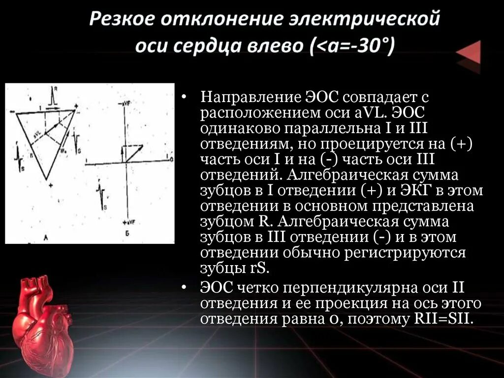 Вертикальная позиция сердца. Отклонение электрической оси сердца на ЭКГ. Отклонения сердечной оси. Отклонение оси резко влево на ЭКГ. Электр ось сердца отклонена влево ЭКГ.