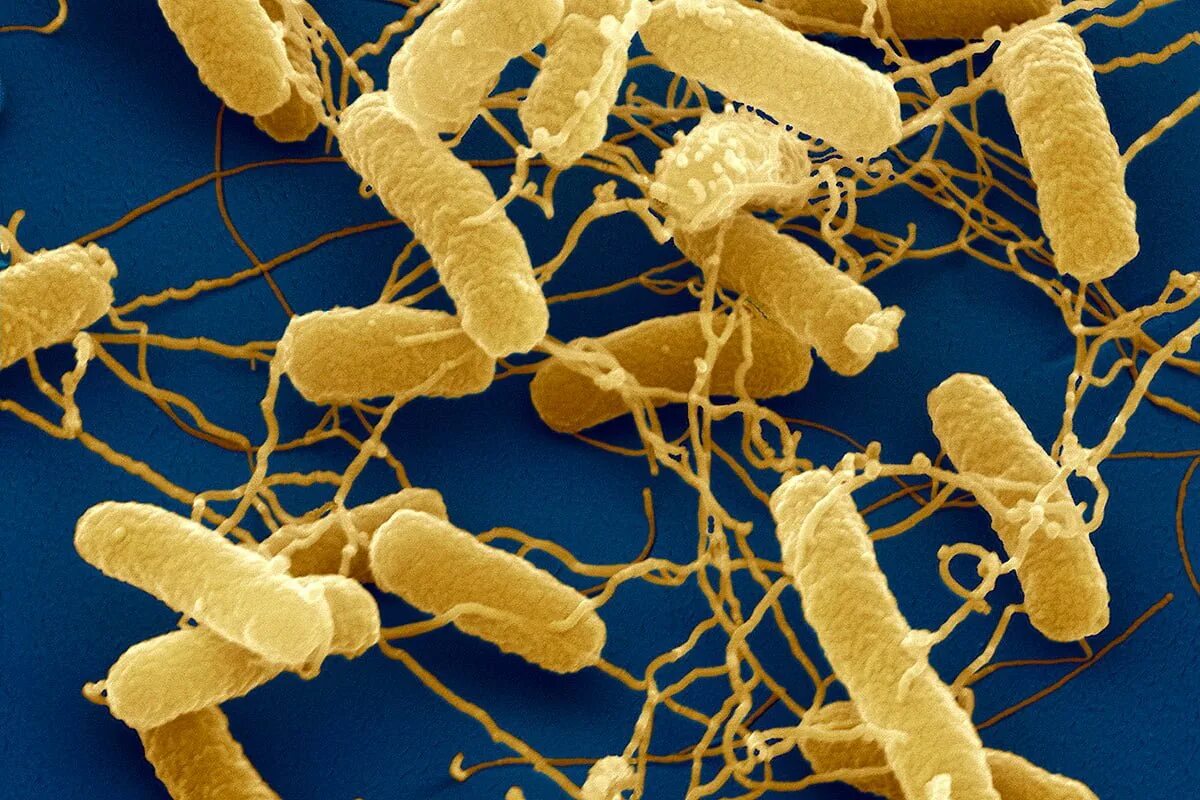 Бактерия Salmonella. Сальмонелла (Salmonella). Болезнетворные бактерии сальмонелла. Сальмонелла холерасуис. Сальмонеллез бактерия