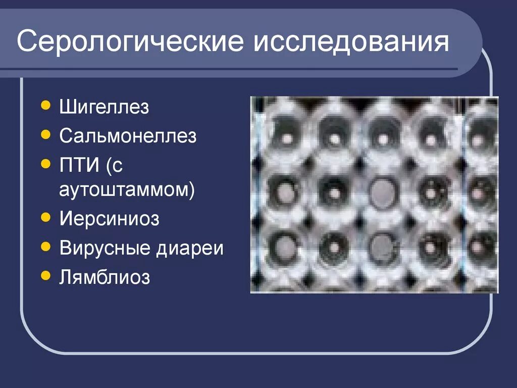 Серологическая диагностика это. Серологические исследования. Серологические методы исследования шигеллезов. Серологический метод исследования шигеллеза. Серологическая диагностика иерсиниоза.