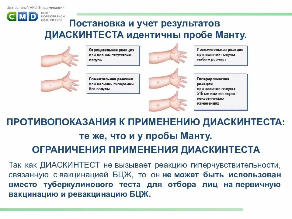 Методика постановки пробы диаскинтест. Постановка внутрикожной пробы диаскинтест. Проба на туберкулез диаскинтест постановка. Методику постановки пробы « диаскинтеста»..