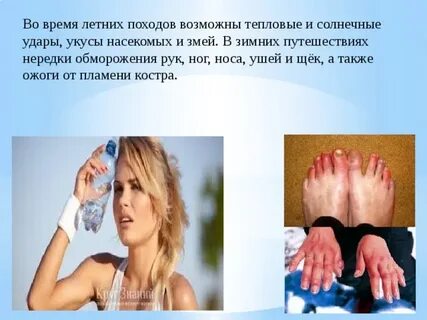 Тепловые солнечные удары обморожения