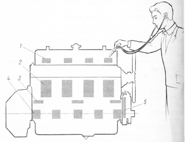 Зоны прослушивания двигателя стетоскопом схема. Зоны прослушивания стуков в ДВС. Зоны прослушивания стуков ДВС рисунок 65. Схема зон прослушивания стуков в двигателе. Стучим схема