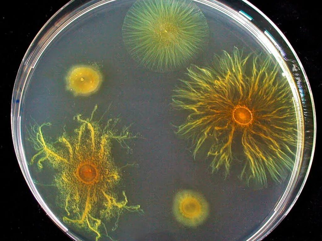 Чашка петри со средой. Колонии бактерий в чашке Петри. Бактерии Myxococcus Xanthus. Чашка Петри с бактериями. Питательная среда 2 ГРМ Сабуро.