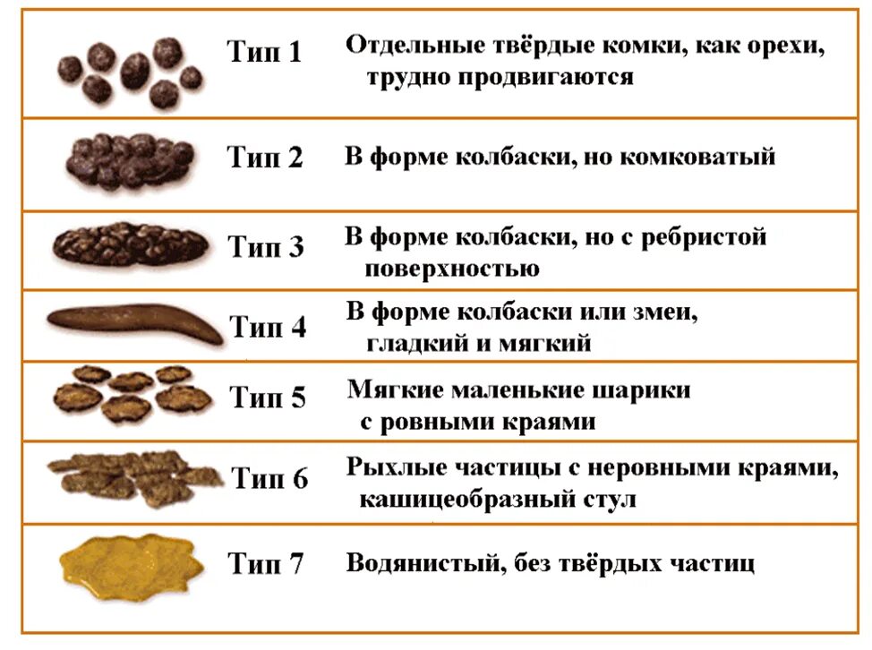 Причины изменение кала. Нормальный стул у взрослого. Нормальный вид кала. Нормальный цвет кала.