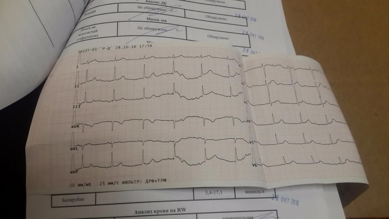 Смещение st вниз avr. Смещение st вниз avr