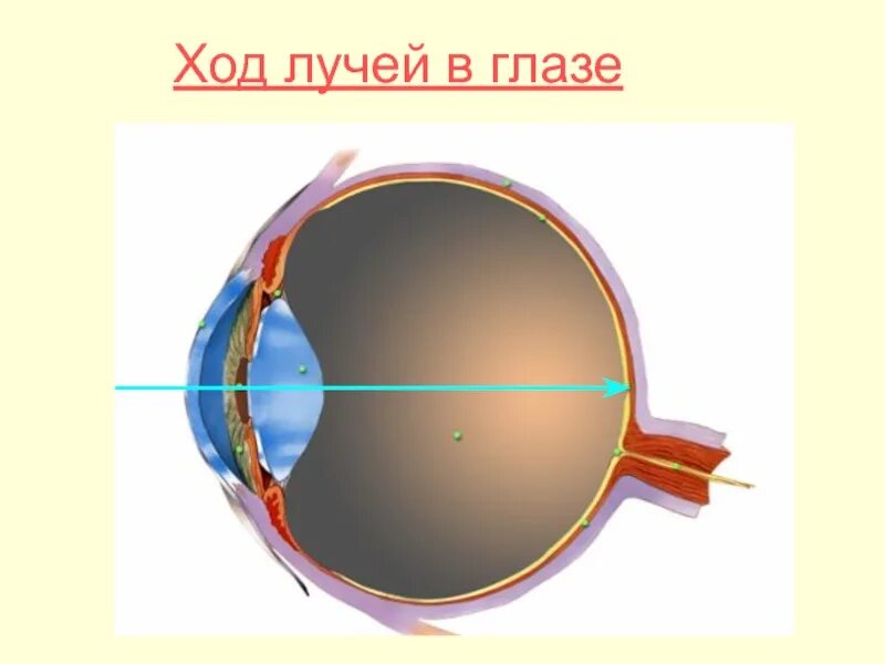 Зрение 8 как видит. Зрение -8. Ход лучей в глазу. Строение глаза 8 класс ход лучей. Как выглядит зрение -8.