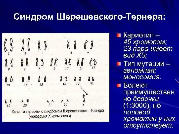 2 хромосома нарушения. Синдром Шерешевского Тернера набор хромосом. Синдром Шерешевского Тернера кариотип. Синдром Тернера кариотип.