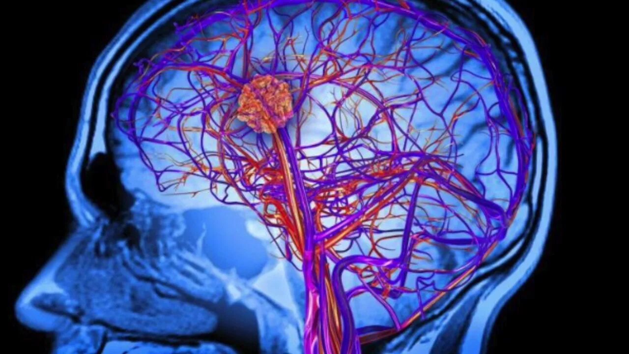 Головной мозг с сосудами артерии и вены. Ангиография головного мозга. Мрт головного мозга и сосудов. Артерии головного мозга на мрт.