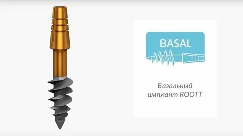 Швейцарские импланты отзывы