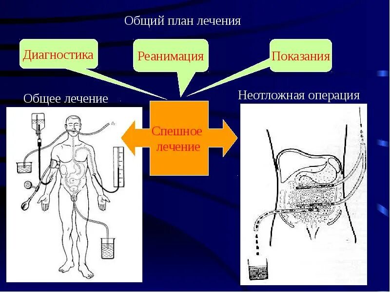 Диагностика перитонита. Лабораторная диагностика перитонита. Методы диагностики перитонита. Диагностика перитонита схема.