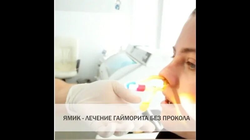 Можно ли вылечить гайморит без прокола. Гайморит без прокалывания. лечится гайморит без прокола. лечение гайморита без прокола лекарства. как вылечиться от гайморита без прокола?.