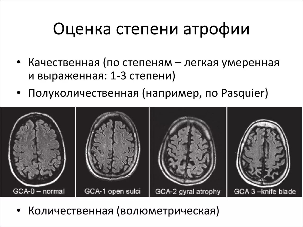 Умеренно выраженная наружная