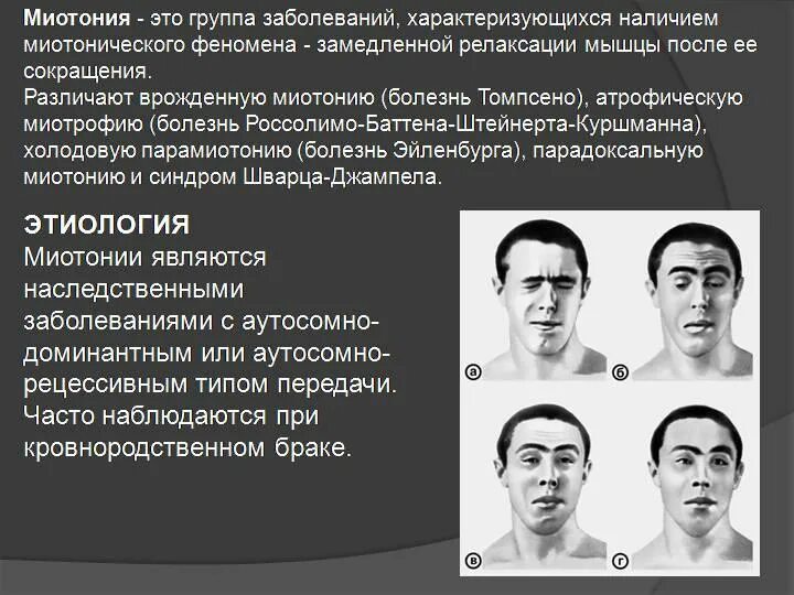 Миотония это. Миотония Россолимо-Штейнерта-Куршманна. Миотония Куршмана Баттена. Миотоническая дистрофия Куршмана-Баттена-Штейнерта. Дистрофическая миотония Россолимо-Куршмана-Штейнерта-Баттена.