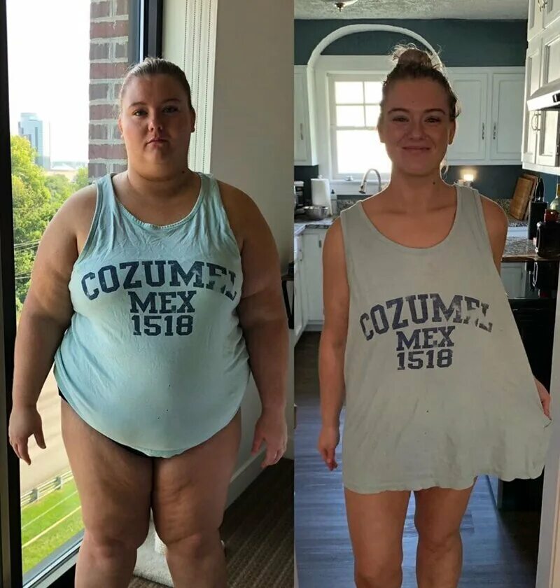 Похудение до и после. Похудение до и после фото. Фото худеющих до и после. До и после похудения девушки. Разница 10 кг