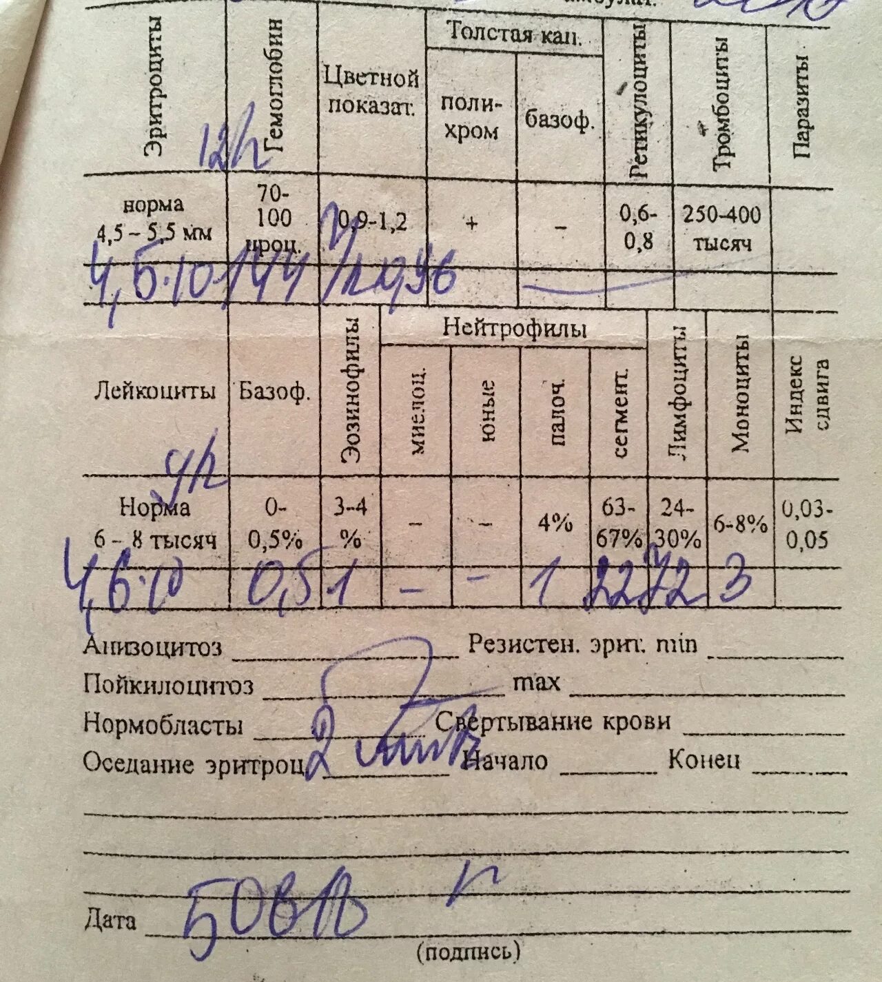 Группа крови результаты анализов. Цилиндроскиаскопия расшифровка результатов. Купон расшифровка анализов. Расшифровка результатов ээгш. Кератотопограмма расшифровка результатов.