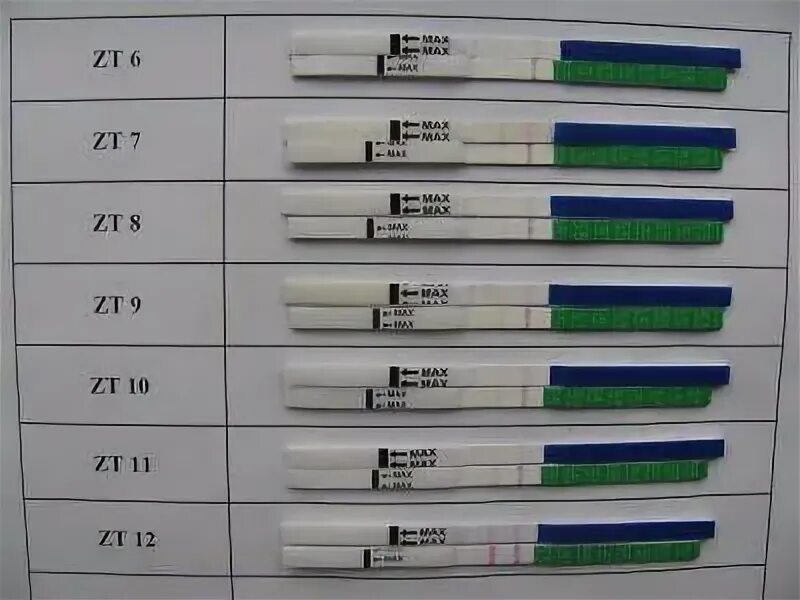 Результаты теста при внематочной. Показывает ли тест внематочную беременность. Внематочная беременность тест. Тест на беременность показывает внематочную беременность. Показывает ли тест при внематочной беременности.