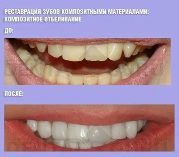 Композитная оценка