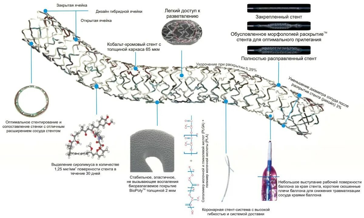 Система доставки стенты. Biomime стент. Biomime des коронарный стент 2.75-16мм. Стент внутрисосудистый Biomime. Стент Biomime 1434.