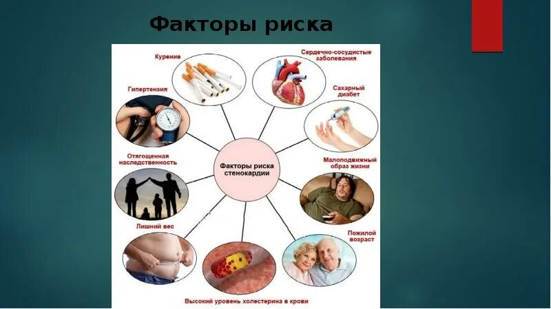 Фактор это в медицине. Факторы риска развития стенокардии. Факторы риска стенокардии стенокардии. Факторы риска при стенокардии. Факторы риска нестабильной стенокардии.