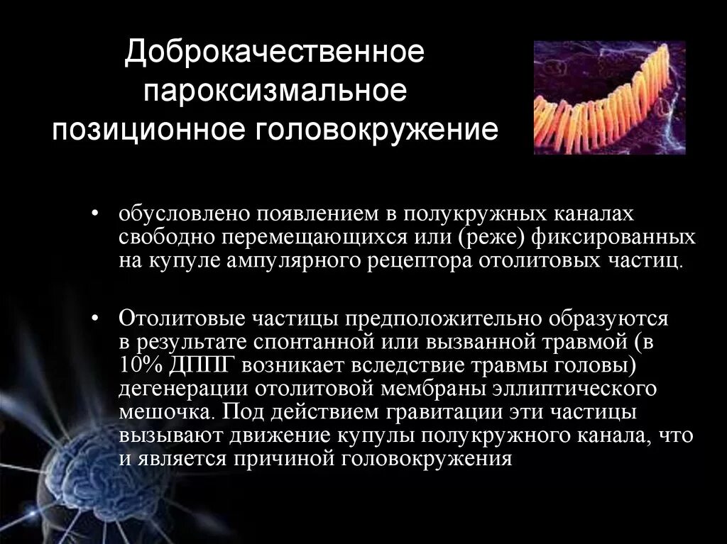 Дппг что это за болезнь. Доброкачественное пароксизмальное головокружение. ДППГ отолиты. Доброкачественное пароксизмальное позиционное головокружение. Доброкачественная головокружение ДППГ.