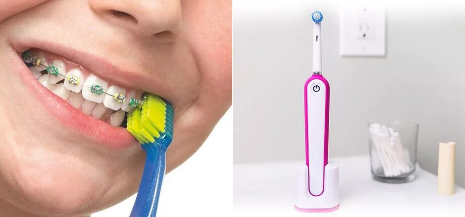 школьник с брекетами с электрической зубной щеткой. ершики для брекетов. отбеливатель для зубов с брекетами. зубная паста для чистки брекетов. можно чистить брекеты электрической зубной щеткой.