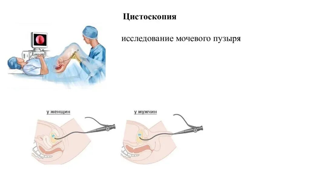 Где делают цистоскопию