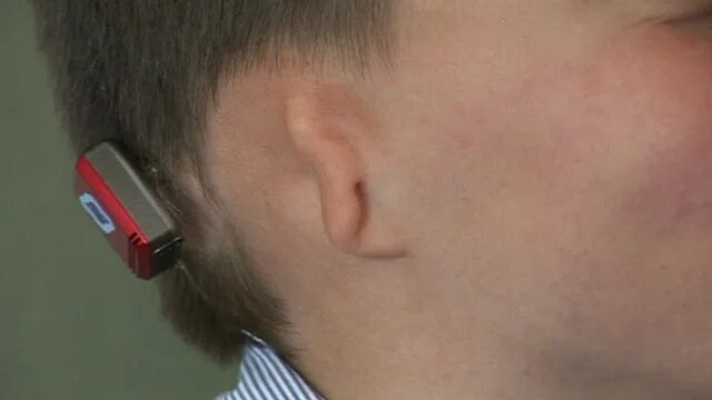 Уши эльфа. Without ears. Новообразование на ушной раковине. Детское ухо. Without ears.