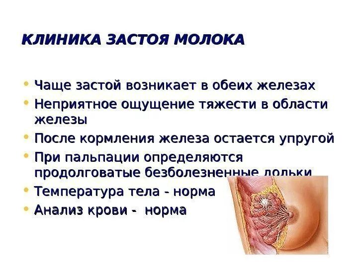 Что такое лактостаз