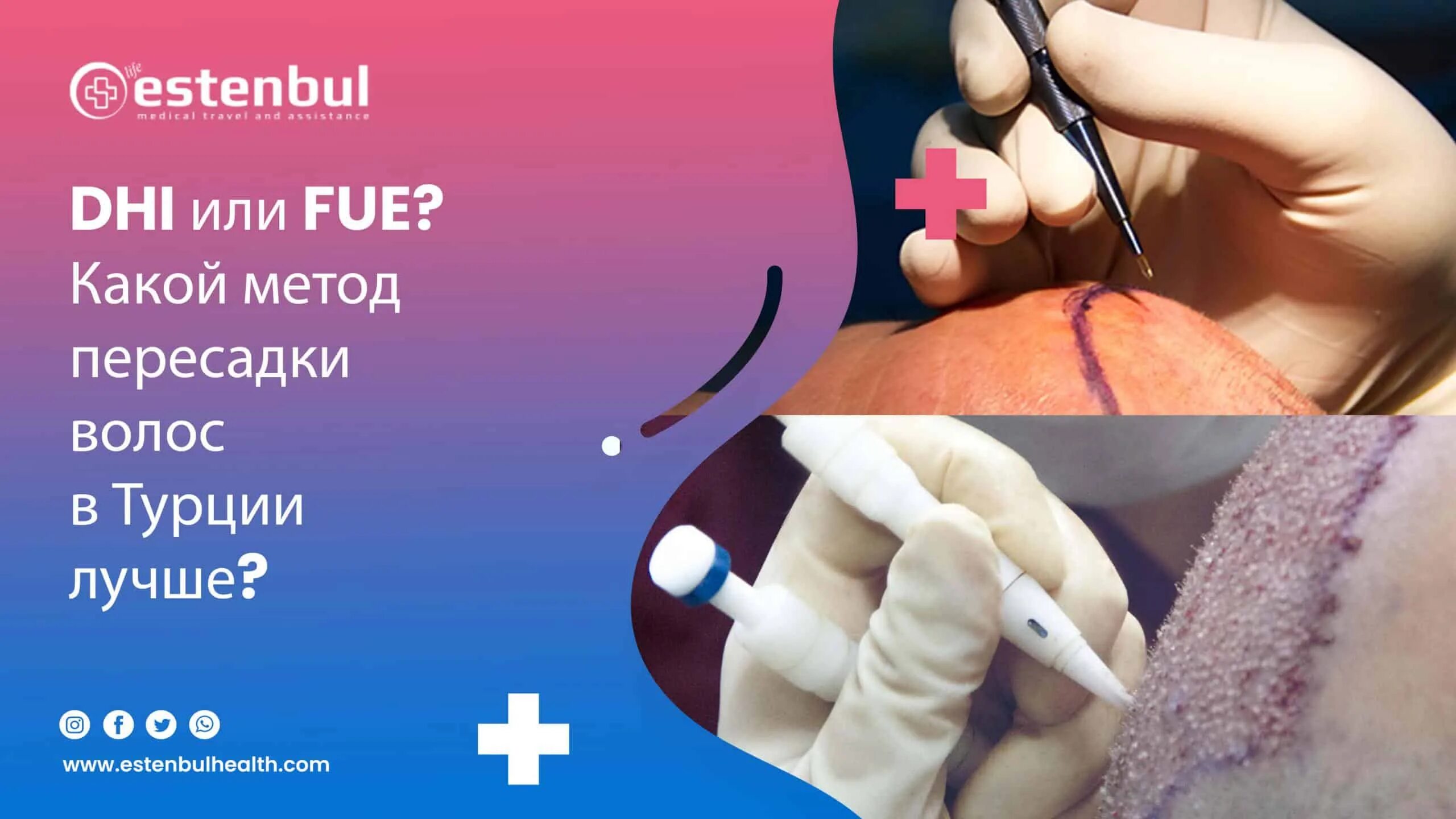 Dhi пересадка. Трансплантация волос на голове. Dhi пересадка. Dhi пересадка. Dhi трансплантация волос.