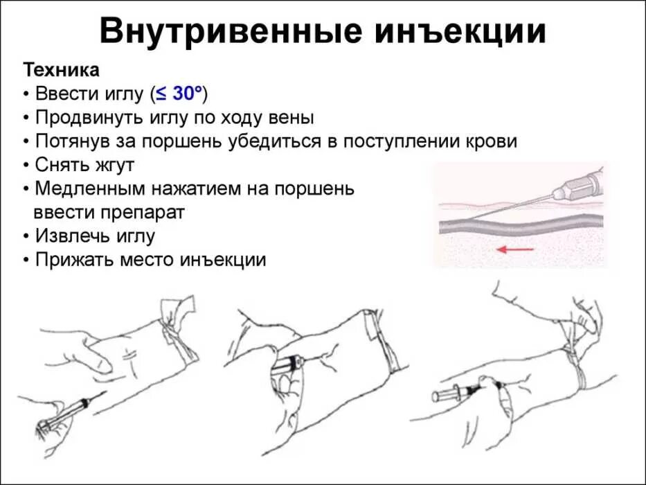 Нужно ввести правильное. При выполнении внутривенной инъекции, игла вводится:. Алгоритм ввода инъекции внутривенно. Внутривенная инъекция глубина введения иглы. Алгоритм внутривенного введения лекарственных.