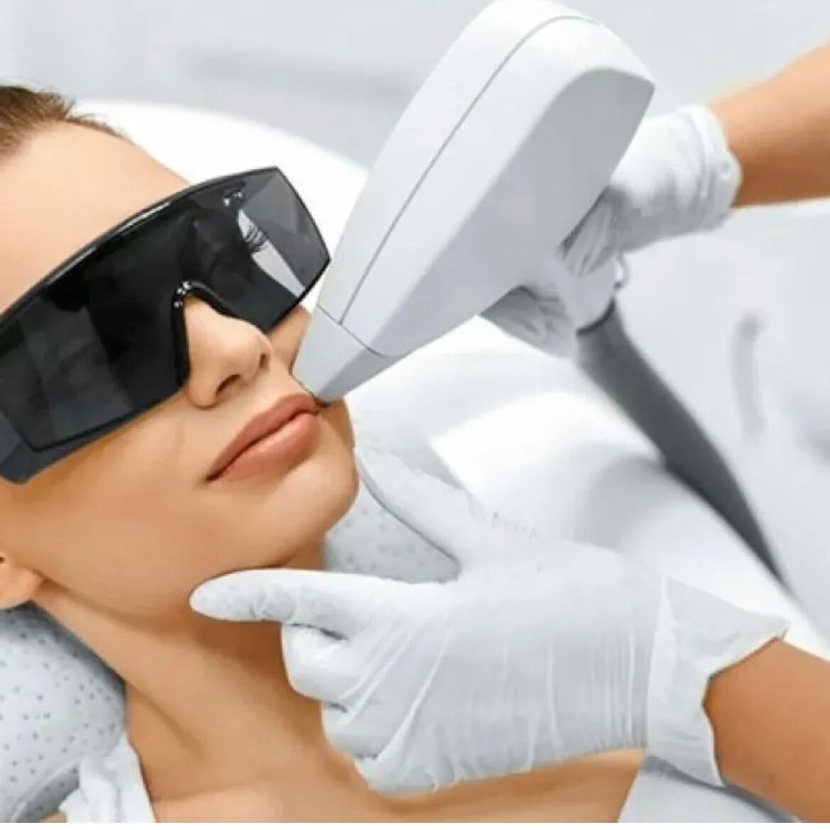 Аппаратная эпиляция. Лазерная эпиляция волос. Лазерная эпиляция. Лазерная эпиляция подмышек. Лазерная эпиляция диодным лазером.