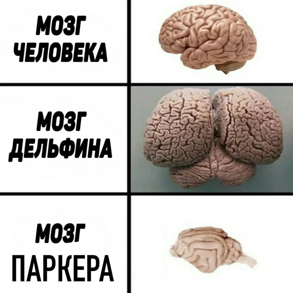 Почему без мозгов. МОЗ Дельфин АИ человека. Мозг дельфина и человека. Мозг человека и дельфина прикол.