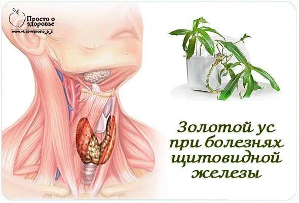 Народное лечение узлов щитовидной железы. Траволечение щитовидной железы. Золотой ус при щитовидной железе. Заговоры от заболеваний щитовидки. Растения при заболеваниях щитовидной железы.