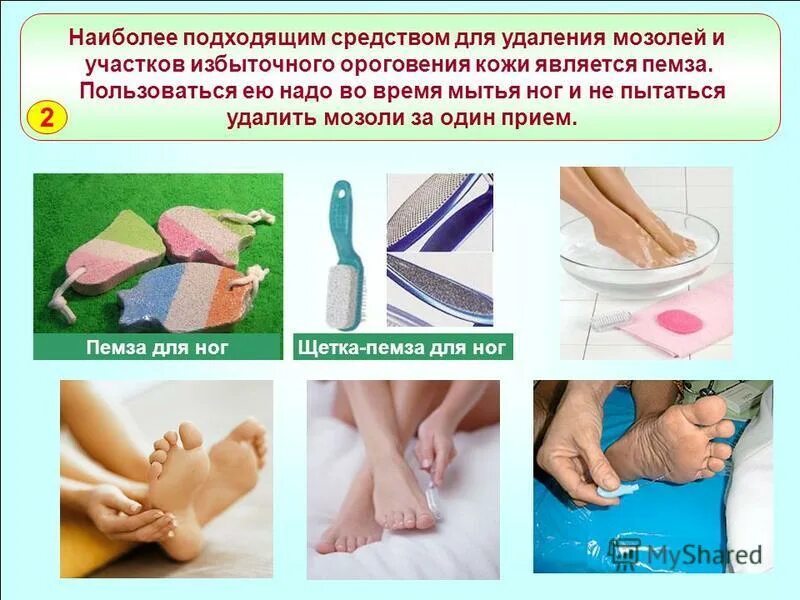 Средства для пяток от огрубевшей кожи. Губка для педикюра. Как пользоваться пемзой для ног правильно. Обработка пяток пемзой. Щетка для пяток с длинной ручкой.