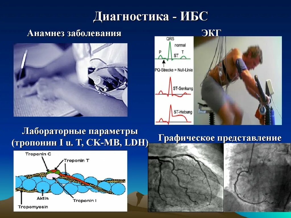 Диагностика ишемии. Ишемия сердца диагностика. Методы диагностики ИБС. Лабораторная диагностика ИБС. Ишемическая болезнь сердца диагност.