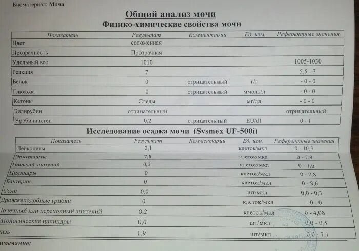 Общий белок при беременности 3 триместр. Норм сахара в моче у грудничка. Глюкоза в моче норма мг/дл. Норма сахара в суточной моче при беременности. Норма сахара в моче.