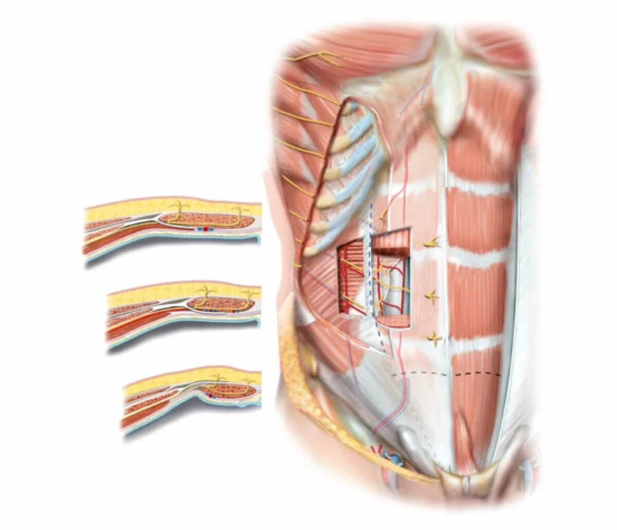 Стенка анатомия. Передняя стенка влагалища прямой мышцы живота. Передняя брюшная стенка топографическая анатомия грыжи. Влагалище прямой мышцы живота анатомия. Задняя стенка влагалища прямой мышцы живота.