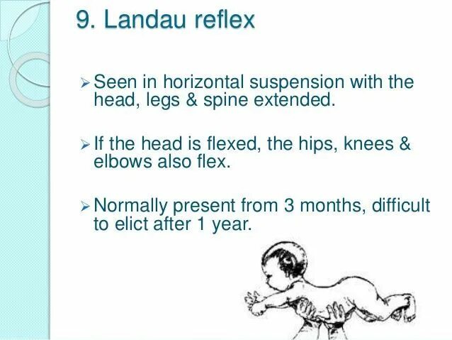 Рефлекс Ландау у новорожденных. Нижний рефлекс Ландау. Верхний рефлекс Ландау. Рефлекс Ландау у грудничка.